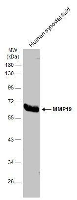 MMP19 antibody